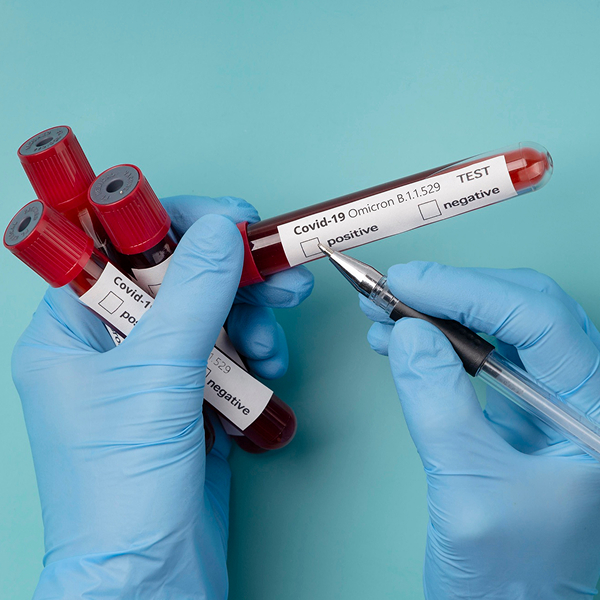 Blood Tests